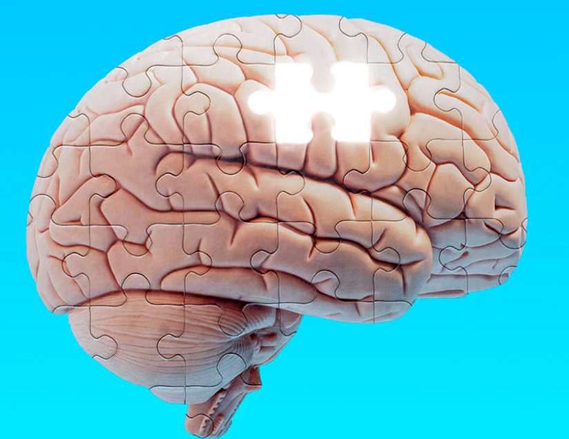 How Kansas can lead on earlier Alzheimer’s detection and care | Kansas City Star | Jeff Burns, MD